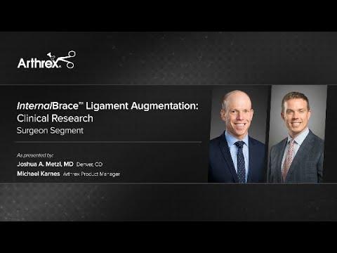 Thumbnail for InternalBrace™ Ligament Augmentation: Clinical Research